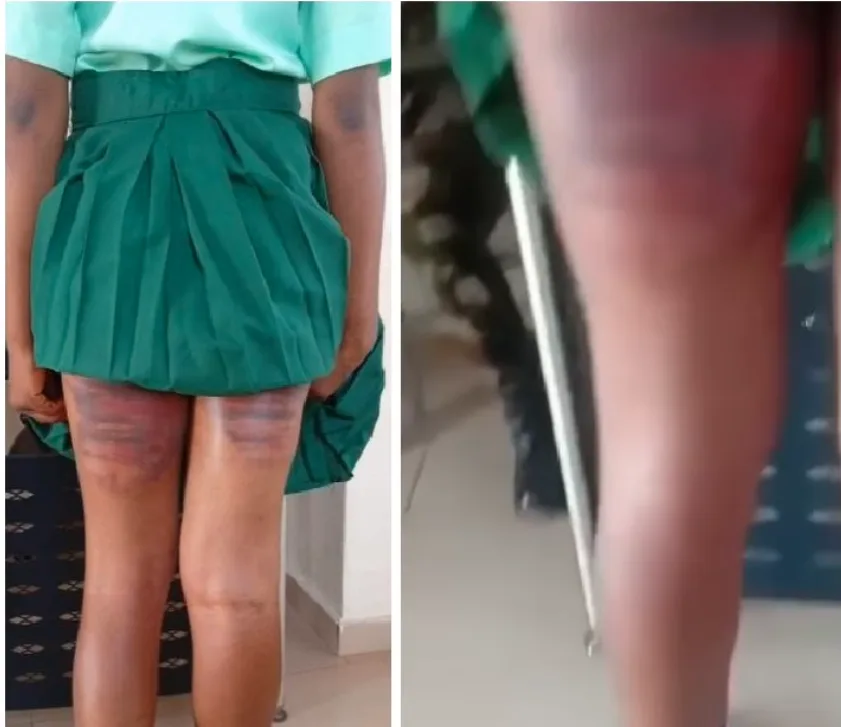 Outrage as SS3 Student Allegedly Brutalised at Command Secondary School, Iyana Ipaja