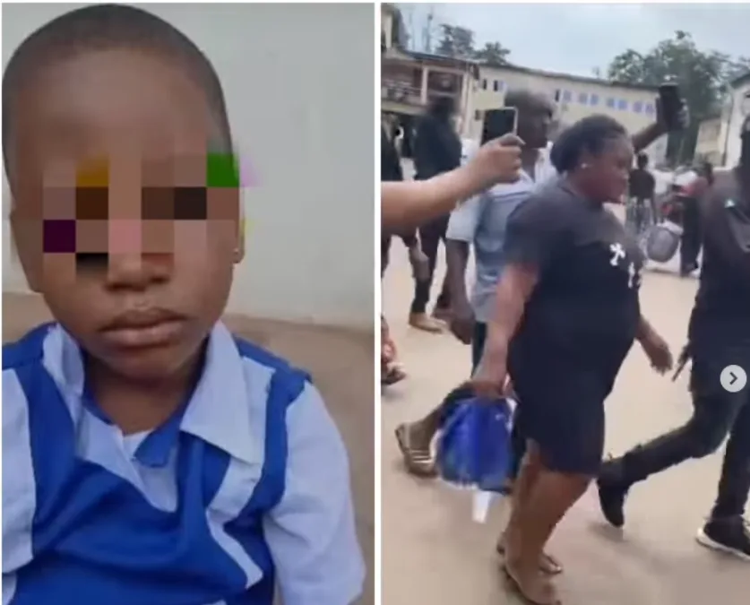 Woman arrested in Enugu for allegedly using razor bl@de to c¥t the toe of child living with her